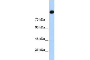 WB Suggested Anti-C2 Antibody Titration:  1. (Complement C2 抗体  (Middle Region))