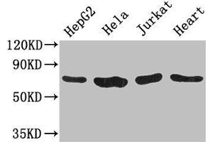 Western Blot Positive WB detected in: HepG2 whole cell lysate, Hela whole cell lysate, Jurkat whole cell lysate, Mouse heart tissue All lanes: CHFR antibody at 3.