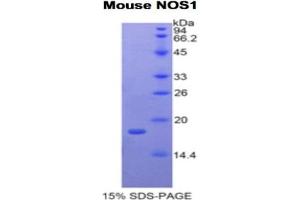 SDS-PAGE analysis of Mouse NOS1 Protein. (NOS1 蛋白)