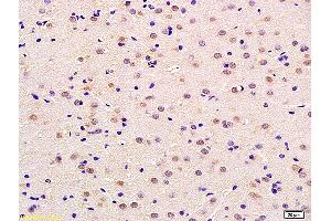 Formalin-fixed and paraffin embedded rat brain labeled with Anti-Neurotrophin 4/NT-4/NT-5 Polyclonal Antibody, Unconjugated (ABIN725615) at 1:200 followed by conjugation to the secondary antibody and DAB staining