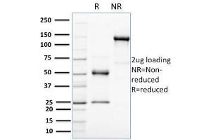 SDS-PAGE Analysis Purified HER-4 / ERBB4 Mouse Monoclonal Antibody (HFR-1). (ERBB4 抗体  (AA 1116-1269))