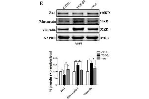Inhibiting the co-transcription complex YAP/TEAD reverses A549 cell proliferation, migration, and invasion induced by TGF-β1. (GAPDH 抗体)