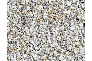 IHC analysis of Ki67/MKI67 using anti-Ki67/MKI67 antibody (ABIN7601873). (Ki-67 抗体  (AA 5-2358))