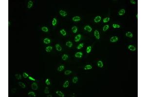 Immunofluorescence staining of Hela cells with ABIN7127707 at 1:100,counter-stained with DAPI.