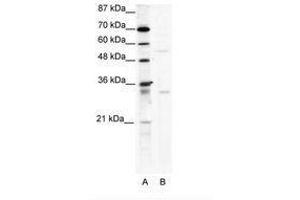 Image no. 1 for anti-TRIM17 / RNF16 (TRIM17) (AA 381-430) antibody (ABIN203174) (TRIM17 / RNF16 抗体  (AA 381-430))