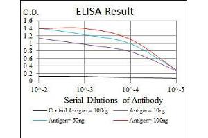 Black line: Control Antigen (100 ng), Purple line: Antigen(10 ng), Blue line: Antigen (50 ng), Red line: Antigen (100 ng), (MAP2K7 抗体)