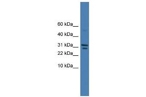 WB Suggested Anti-SPINT2 Antibody Titration: 0. (SPINT2 抗体  (C-Term))