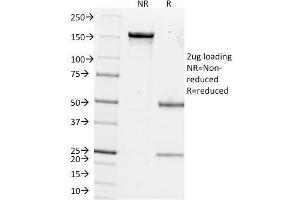 SDS-PAGE Analysis Purified pS2 Mouse Monoclonal Antibody (GE2). (TFF1 抗体  (AA 57-84))