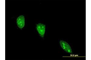 Immunofluorescence of monoclonal antibody to ANGPTL7 on HeLa cell. (ANGPTL7 抗体  (AA 27-126))