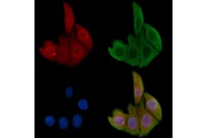 ABIN6256564 and ABIN6267470 staining Hela cells by IF/ICC.