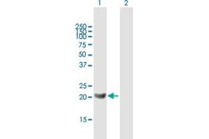 Western Blot analysis of GM2A expression in transfected 293T cell line by GM2A MaxPab polyclonal antibody. (GM2A 抗体  (AA 1-193))