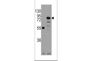 Western blot analysis of CDH9 using rabbit polyclonal CDH9 Antibody using 293 cell lysates (2 ug/lane) either nontransfected (Lane 1) or transiently transfected with the CDH9 gene (Lane 2). (Cadherin 9 抗体  (C-Term))