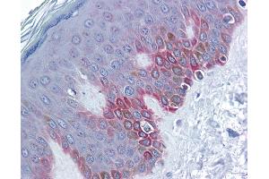 Immunohistochemistry (IHC) image for anti-Frizzled Family Receptor 5 (FZD5) (Middle Region) antibody (ABIN2776705) (FZD5 抗体  (Middle Region))