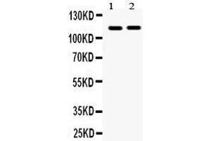Observed bind size: 114KD (EPH Receptor A5 抗体  (C-Term))