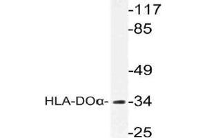 Western blot (WB) analysis of HLA-DOalpha antibody in extracts from COLO cells. (HLA-DOA 抗体)