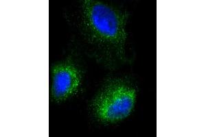 Immunofluorescent analysis of 4 % paraformaldehyde-fixed, 0. (Surfactant Protein C 抗体  (N-Term))
