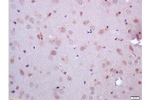 Formalin-fixed and paraffin embedded rat brain labeled with Anti-ARHI Polyclonal Antibody, Unconjugated (ABIN681448) at 1:200 followed by conjugation to the secondary antibody and DAB staining (DIRAS3 抗体  (AA 131-229))