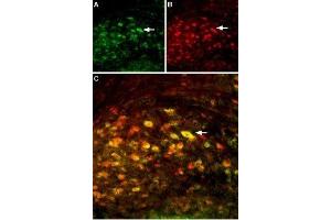 Multiplex staining of GluN2A and GluN2B in mouse deep cerebellar nucleusImmunohistochemical staining of perfusion-fixed frozen mouse brain sections using Anti-NMDAR2B (GluN2B) (extracellular)-ATTO Fluor-594 Antibody (ABIN7043231), (1:60) and Anti-NMDAR2A (GluN2A) (extracellular) Antibody (ABIN7043228, ABIN7044324 and ABIN7044325), (1:200). (Glutamate Receptor, Ionotropic, N-Methyl D-Aspartate 2a (GRIN2A) Peptide)