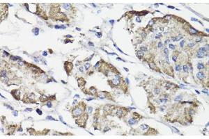 Immunohistochemistry of paraffin-embedded Human stomach using WASF3 Polyclonal Antibody at dilution of 1:100 (40x lens). (WASF3 抗体)