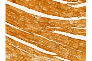 ABIN6263218 and ABIN6273007 at 1/100 staining Mouse heart tissue by IHC-P.