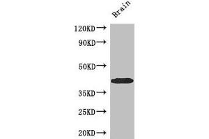 Western Blot Positive WB detected in: Mouse brain tissue All lanes: SPDEF antibody at 3 μg/mL Secondary Goat polyclonal to rabbit IgG at 1/50000 dilution Predicted band size: 38, 36 kDa Observed band size: 38 kDa (SPDEF/PSE 抗体  (AA 145-247))