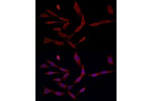 Immunofluorescence (IF) image for anti-Ferritin, Heavy Polypeptide 1 (FTH1) (AA 1-183) antibody (ABIN3021539)
