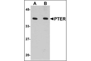 Western blot analysis of PTER in human kidney tissue lysate with this product at (A) 1 and (B) 2 μg/ml. (PTER 抗体  (C-Term))