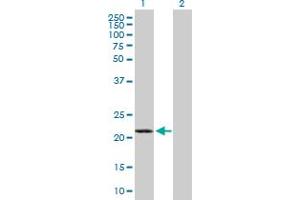 Western Blot analysis of GCET2 expression in transfected 293T cell line by GCET2 MaxPab polyclonal antibody. (GCET2 抗体  (AA 1-178))