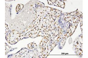 Immunoperoxidase of monoclonal antibody to RUNX2 on formalin-fixed paraffin-embedded human placenta. (RUNX2 抗体  (AA 251-350))