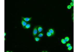 Immunofluorescent staining of HT29 cells using anti-AK1 mouse monoclonal antibody (ABIN2452270). (Adenylate Kinase 1 抗体)