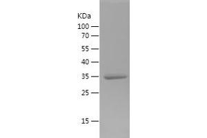 Western Blotting (WB) image for Macrophage Migration Inhibitory Factor (Glycosylation-Inhibiting Factor) (MIF) (AA 2-115) protein (His-IF2DI Tag) (ABIN7283787) (MIF Protein (AA 2-115) (His-IF2DI Tag))