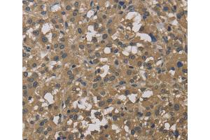 Immunohistochemistry (IHC) image for anti-Dynactin 3 (p22) (Dctn3) antibody (ABIN2429911) (DCTN3 抗体)