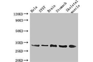 Western Blot Positive WB detected in: Hela whole cell lysate, SH-SY5Y whole cell lysate, Mouse brain tissue, Mouse stomach tissue, Mouse skeletal muscle tissue All lanes: GJB3 antibody at 3 μg/mL Secondary Goat polyclonal to rabbit IgG at 1/50000 dilution Predicted band size: 31 kDa Observed band size: 31 kDa (Connexin 31 抗体  (AA 211-270))