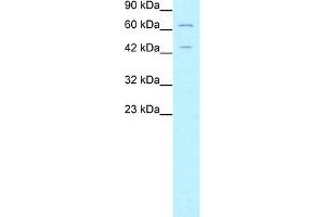 WB Suggested Anti-FOXP3 Antibody Titration:  5. (FOXP3 抗体  (N-Term))