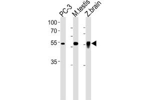 Western Blotting (WB) image for anti-DMRT-Like Family A2 (DMRTA2) antibody (ABIN3001241) (DMRTA2 抗体)
