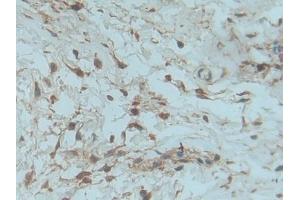 Used in DAB staining on fromalin fixed paraffin- embedded kidney tissue (PDGF-BB Homodimer (AA 82-190) 抗体)