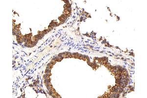 Immunohistochemistry analysis of paraffin-embedded mouse lung using CK-8 Polyclonal Antibody at dilution of 1:200. (KRT8 抗体)