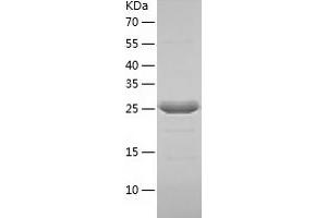 Western Blotting (WB) image for General Transcription Factor IIE, Polypeptide 2 (GTF2E2) (AA 1-291) protein (His tag) (ABIN7123075) (GTF2E2 Protein (AA 1-291) (His tag))