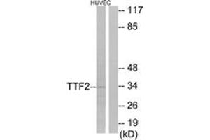 Western blot analysis of extracts from HuvEc cells, using TTF2 Antibody. (TTF2 抗体  (AA 10-59))