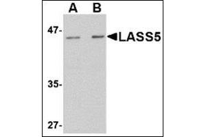 Western blot analysis of LASS5 in rat brain tissue lysate with this product at (A) 1 and (B) 2 μg/ml. (LASS5 抗体  (N-Term))