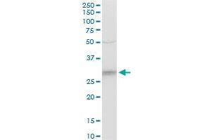 CYB5R3 polyclonal antibody (A01), Lot # AUL1060606QCS1. (CYB5R3 抗体  (AA 1-301))
