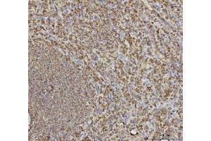 IHC analysis of VPS53 using anti-VPS53 antibody (ABIN7599731).