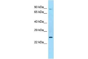 Western Blotting (WB) image for anti-Sex Hormone Binding Globulin (SHBG) (N-Term) antibody (ABIN2789332) (SHBG 抗体  (N-Term))