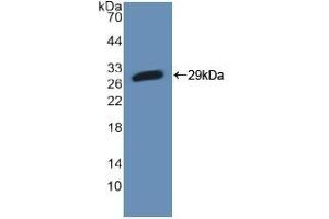 Detection of Recombinant PFKP, Mouse using Polyclonal Antibody to Phosphofructokinase, Platelet (PFKP) (PFKP 抗体  (AA 247-473))