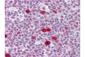 Immunohistochemistry (IHC) image for anti-TSC22 Domain Family, Member 3 (TSC22D3) (AA 1-98) antibody (ABIN614600) (TSC22D3 抗体  (AA 1-98))