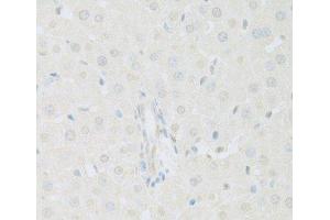 Immunohistochemistry of paraffin-embedded Rat liver using KAT2A Polyclonal Antibody at dilution of 1:100 (40x lens). (KAT2A 抗体)