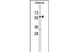 LEMD2 Antibody (N-term) (ABIN1538922 and ABIN2838288) western blot analysis in Uterus tissue lysates (35 μg/lane). (LEMD2 抗体  (N-Term))