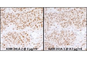 Immunohistochemistry (IHC) image for anti-Replication Protein A1, 70kDa (RPA1) (AA 350-400) antibody (ABIN7453556)