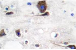 Image no. 1 for anti-Neuregulin 1 (NRG1) antibody (ABIN265466) (Neuregulin 1 抗体)