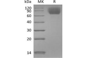 NTRK3 Protein (His tag)